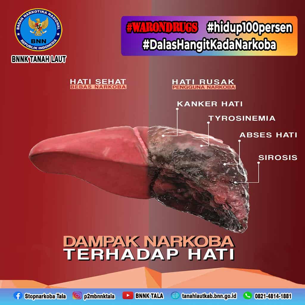 Dampak Narkoba Terhadap Hati Dampak Narkoba Terhadap Hati