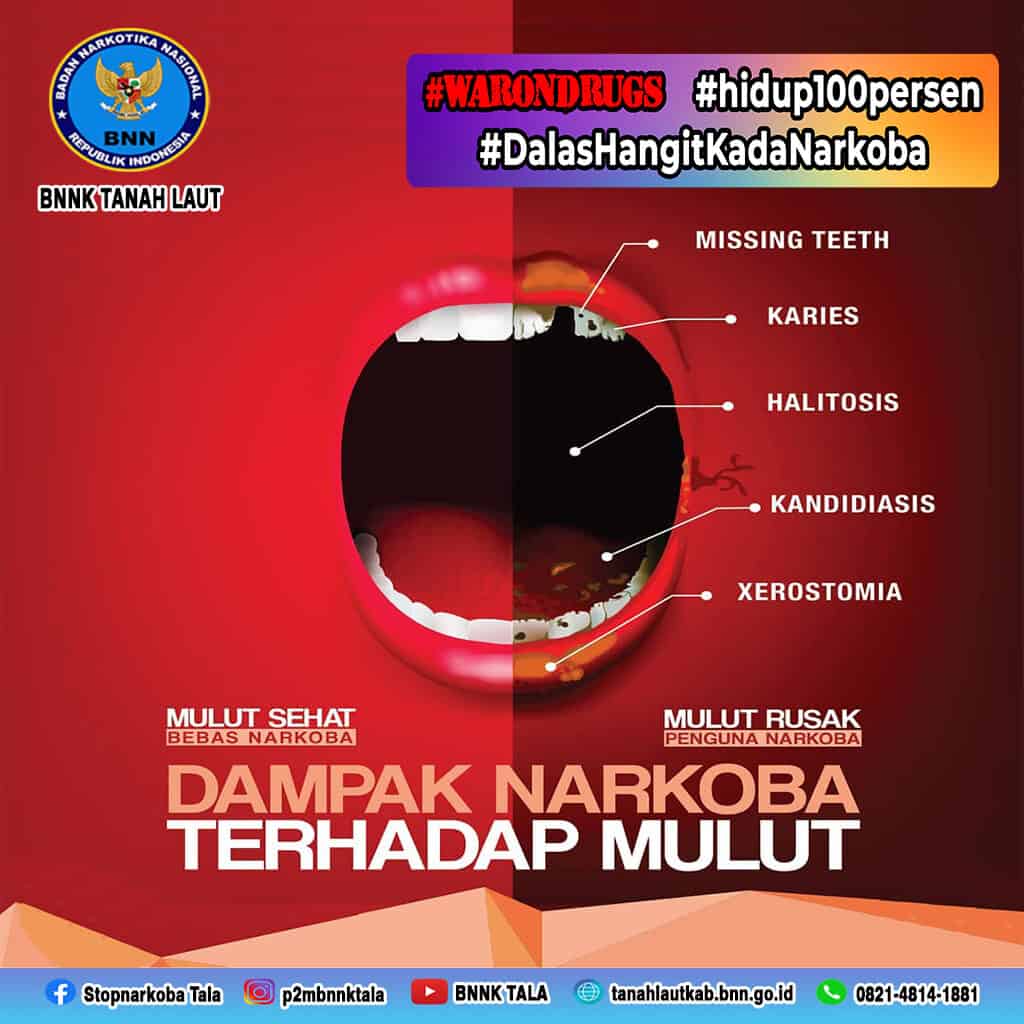 Dampak Narkoba Terhadap Mulut Dampak Narkoba Terhadap Mulut